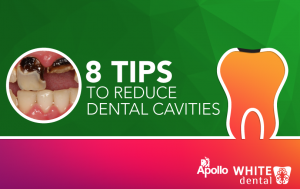 8 Tips To Reduce Dental Cavities